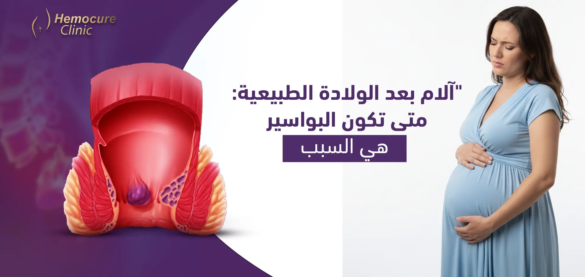 آلام بعد الولادة الطبيعية: متى تكون البواسير هي السبب؟ | دليل "هيموكيور" الشامل