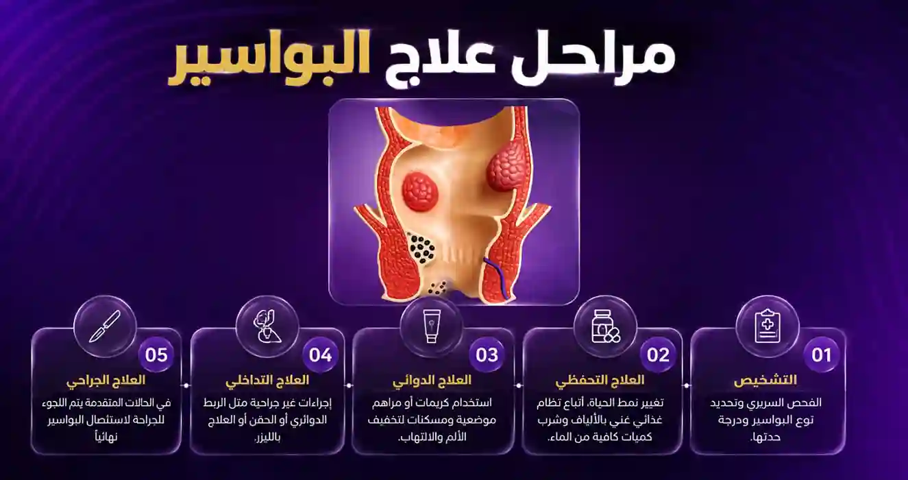 علاج البواسير: الدليل الشامل لكل الطرق من المنزل إلى الليزر
