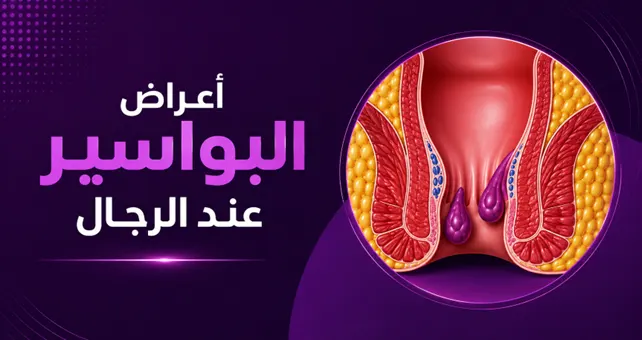 دليل شامل: أعراض البواسير عند الرجال وأحدث طرق العلاج (2026)