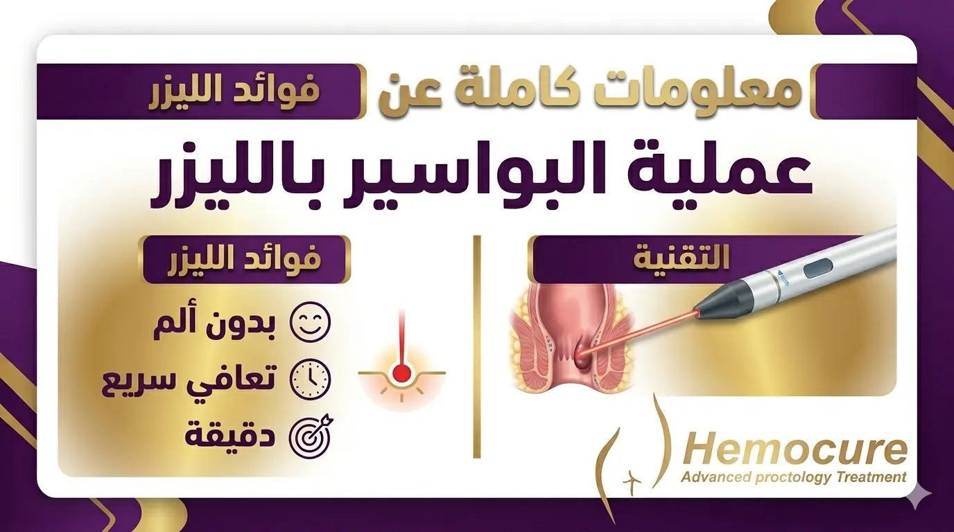 معلومات كاملة عن عملية البواسير بالليزر